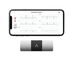 AliveCor KardiaMobile 6L Personal EKG Monitor, Black - KM-6L-E