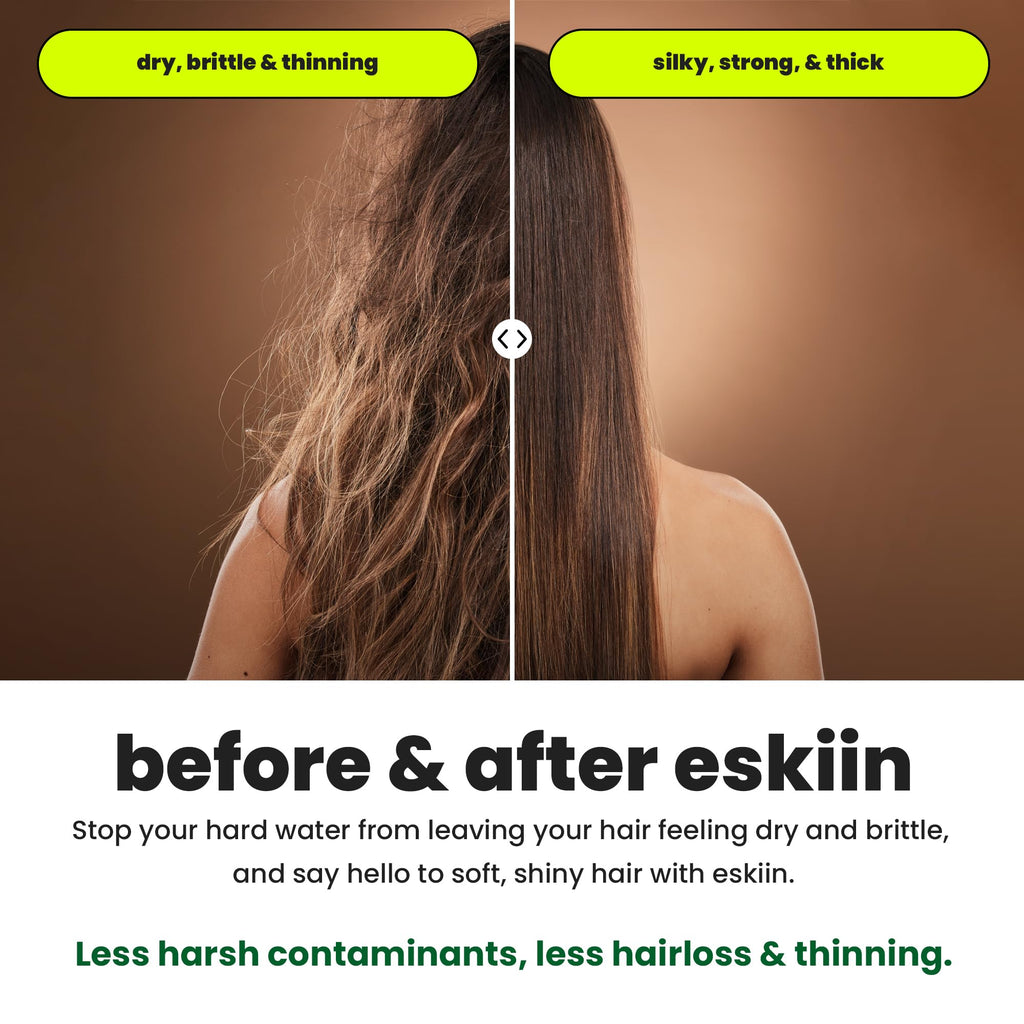 Eskiin Filtered Showerhead With Replaceable Shower Filter